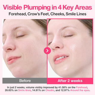 Numbuzin – No.2 Rose PDRN Collagen Plumping Serum DUO Trial Kit, 1.2ml*10ea