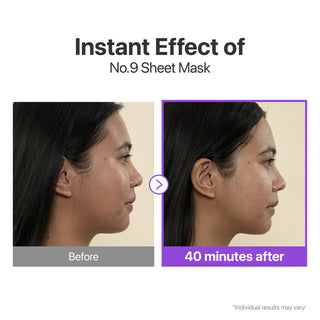 Numbuzin - No.9 NAD+ Bio Lifting-sil Full Face Mask, 28ml, 1 piece
