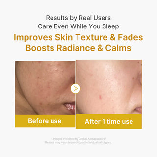 MEDICUBE – Kojic Acid Turmeric Night Wrapping Mask, 75ml