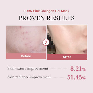 Medicube PDRN Pink Collagen Gel Mask 28 g