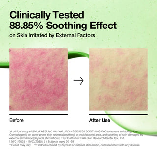 Anua – Azelaic Acid 10 Hyaluron Redness Soothing Pad, 230ml (90ea)